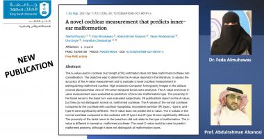 New publication for Prof.Abdulrahman Alsanosi and Dr.Fida Almuhawas