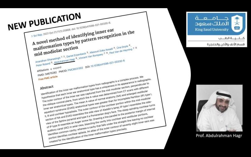 A novel method of identifying inner ear malformation types by pattern recognition in the mid modiolar section
